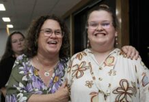 Connections formed at ball